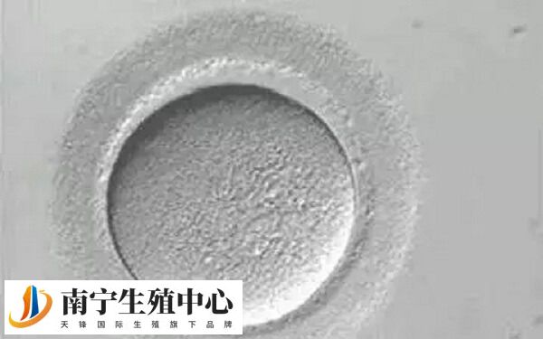 透明带异常可能导致囊胚孵出困难